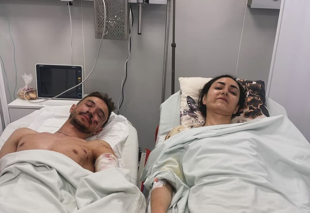 «Живі і це головне»: поранений працівник рятувальної служби 